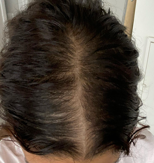 Before: customer