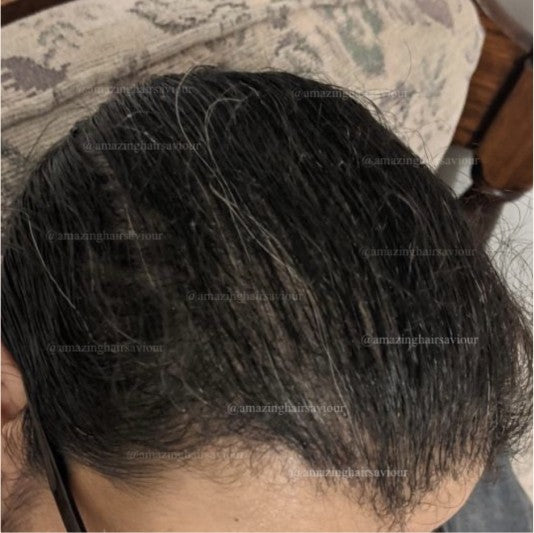 Customer hair after using Amazing Hair Saviour