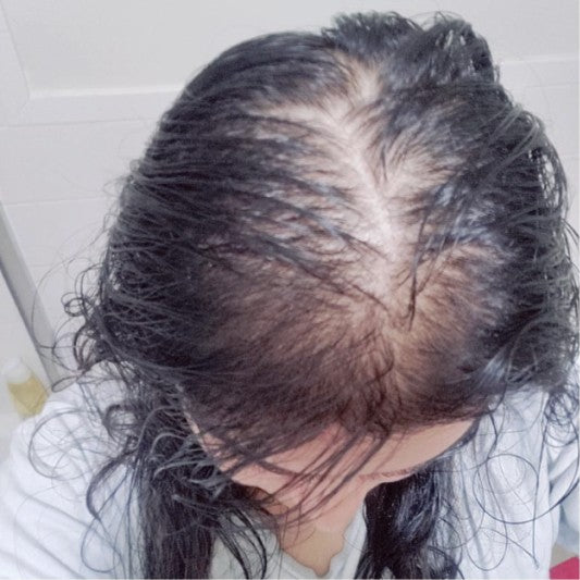 Customer hair before using Amazing Hair Saviour