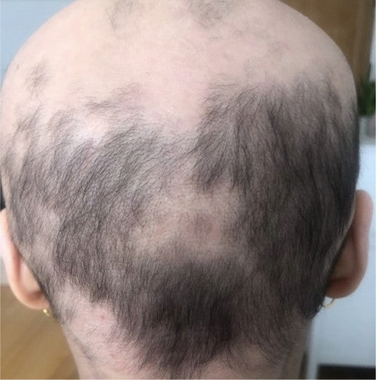 Customer hair after using Amazing Hair Saviour