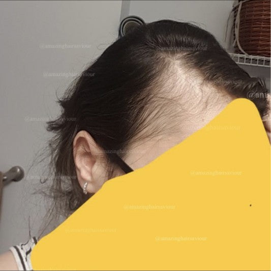 Customer hair before using Amazing Hair Saviour